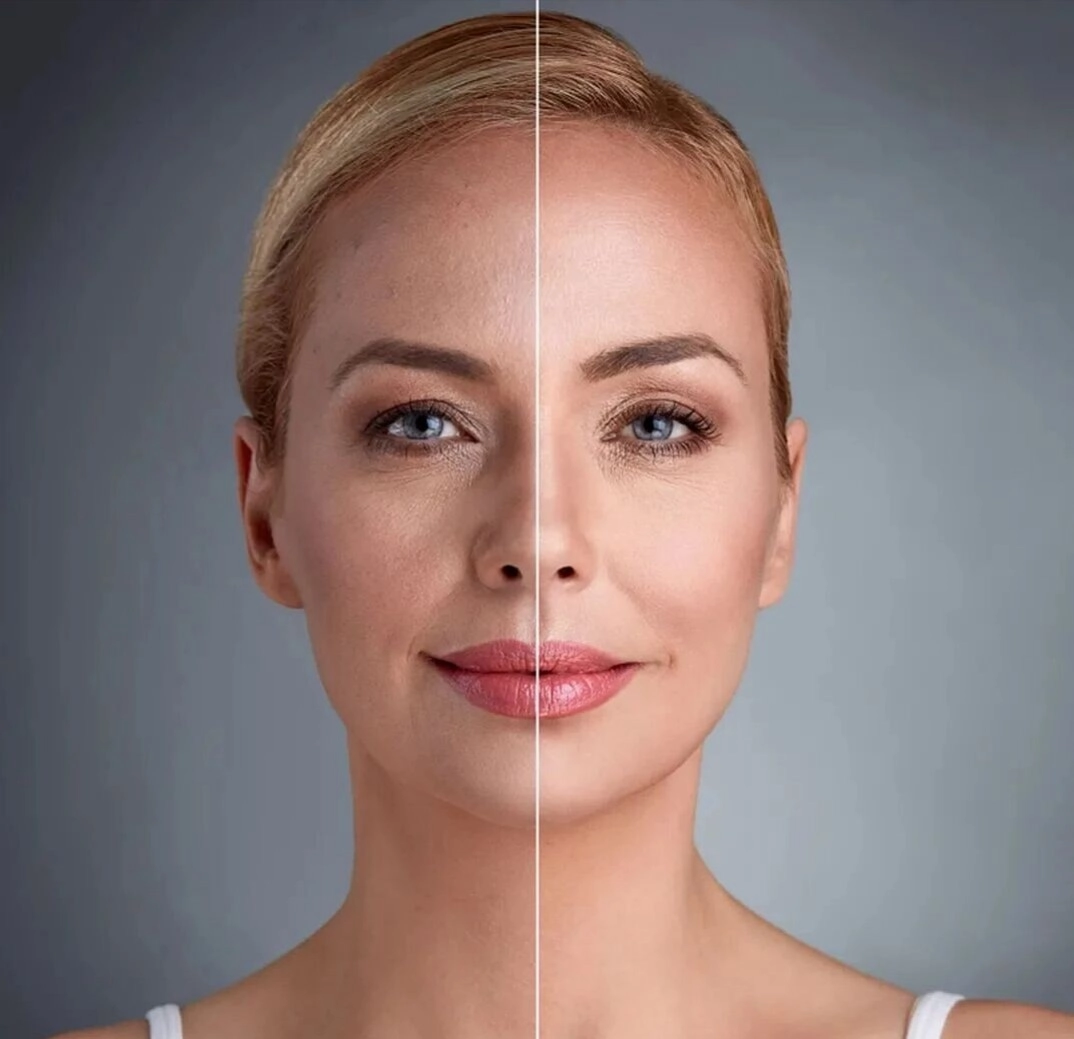 膠原蛋白/彈力蛋白/生長因子